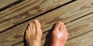 Jaka woda przy dnie moczanowej?